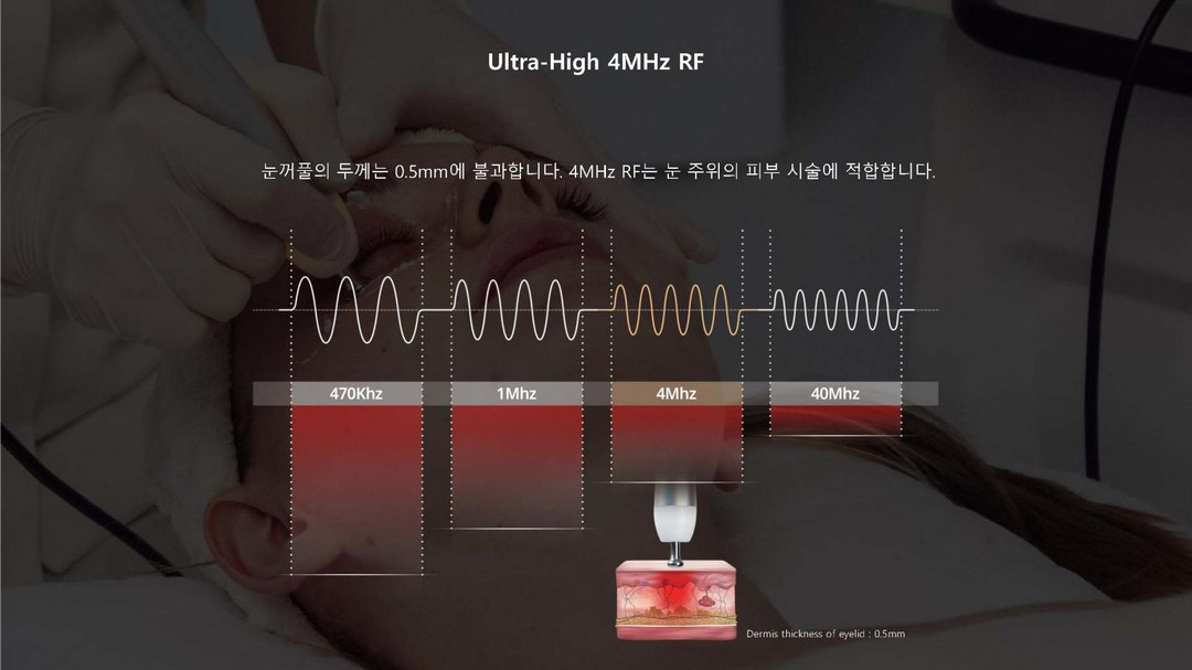 470Khz, 1Mhz, 4Mhz, 40Mhz 주파수별 침투 깊이 비교