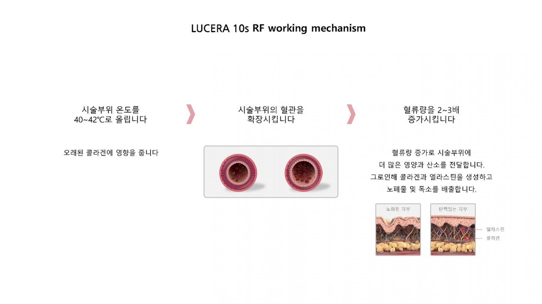 LUCERA 10s RF 작용 메커니즘