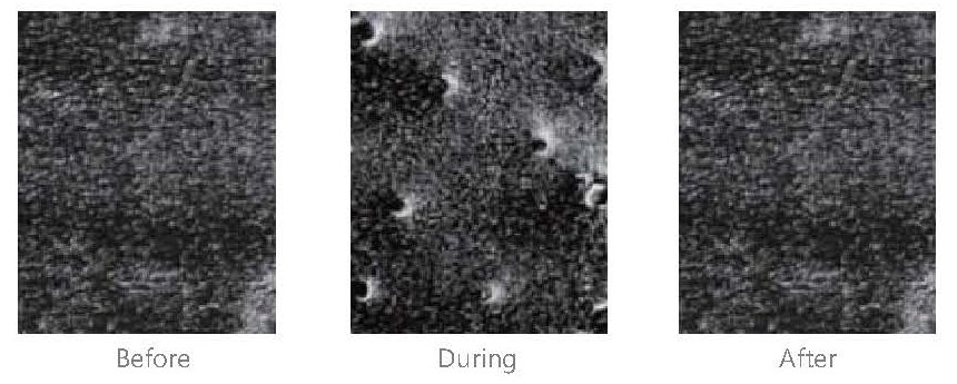 Electroporation 피부 조직 Before, During, After 현미경 사진