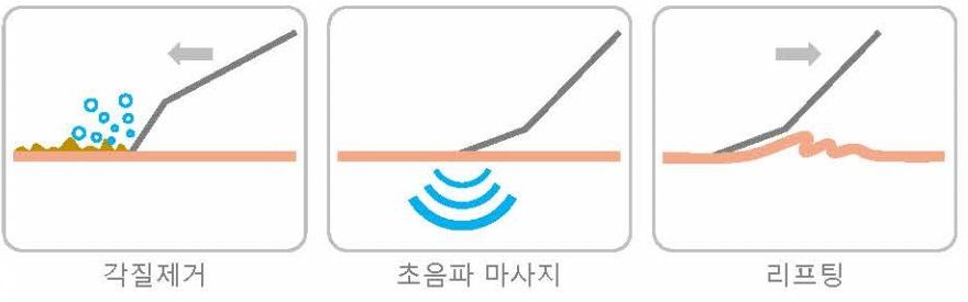 스크러버 기능 도해: 각질제거, 초음파 마사지, 리프팅
