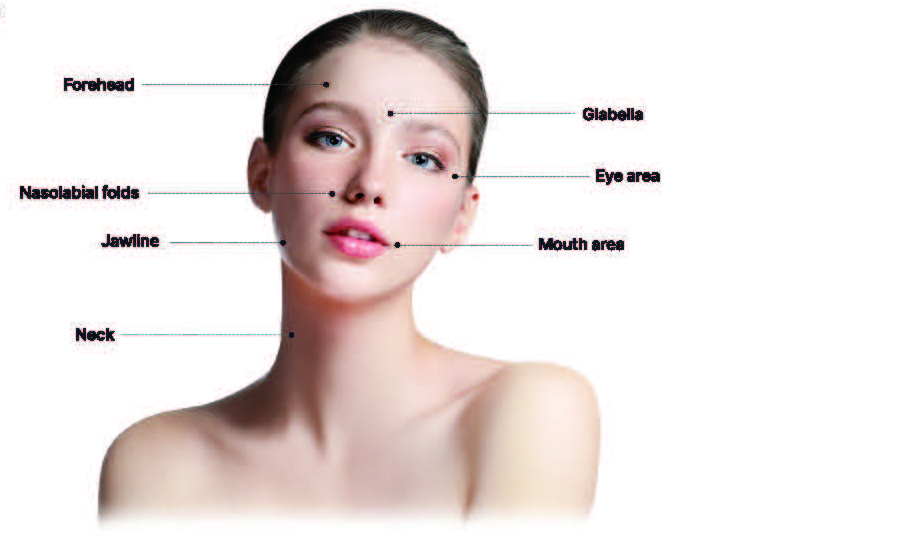 Face 시술 부위: Forehead, Glabella, Nasolabial folds, Eye area, Jawline, Mouth area, Neck